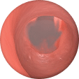 Airway irritant exposure